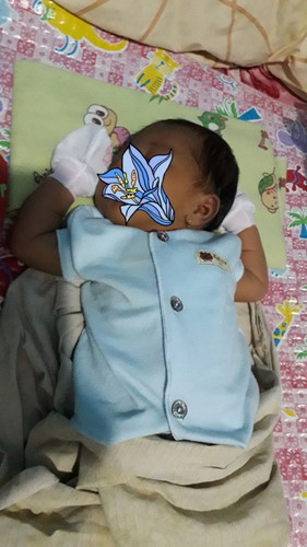 Bayi 2 mnggu tidur miring