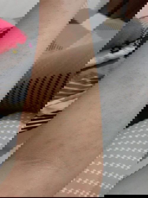 Gatal dan ruam saat hamil 36 minggu