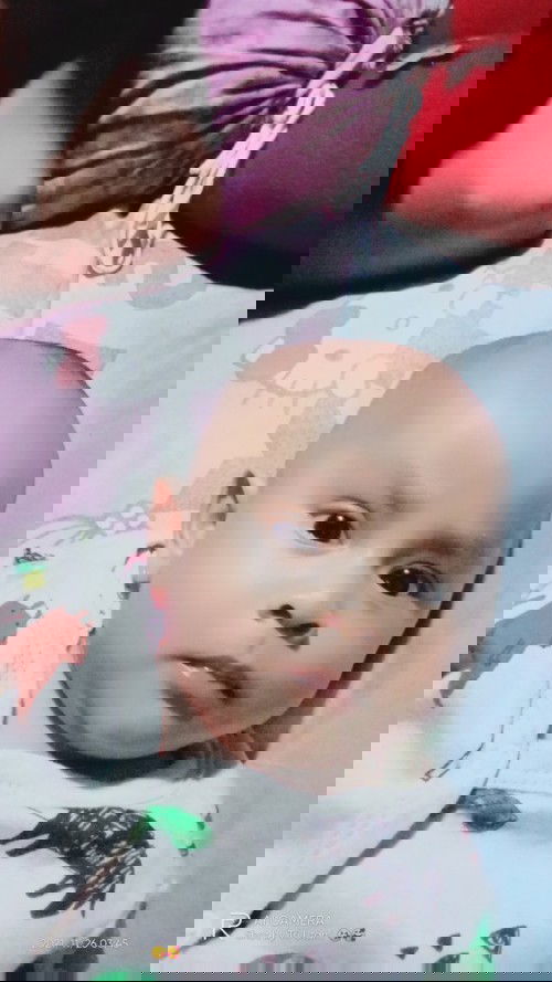 Normalkah bayi jarang bab