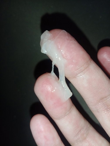 38 weeks mucus plug