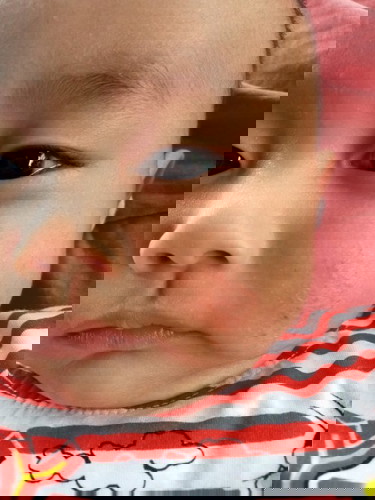 แก้มลูกแตกหน้าหนาว