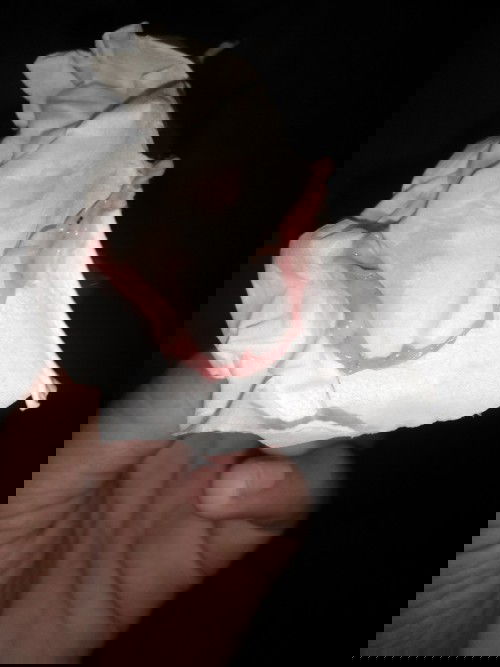 สอบถามค่ะ แบบนี้คืออะไรหรอคะ หมูกเลือดรึอะไรคะ  41+1 week