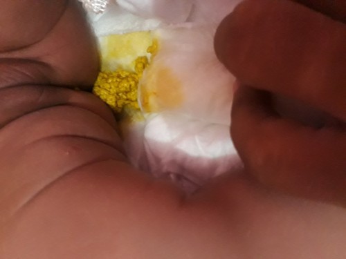 Pup keras seperti taik kambing