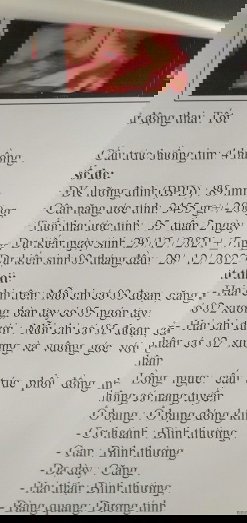 Như vậy là ok k các bạn