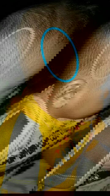 Kepala bayi sebelah kanan gak rata