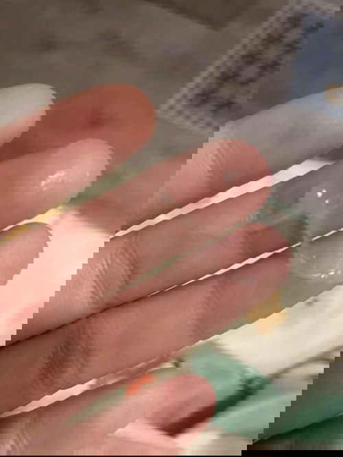 มูกใสออกแบบนี้ แต่ท้องแข็งไม่ถี่ ไม่ปวดท้อง