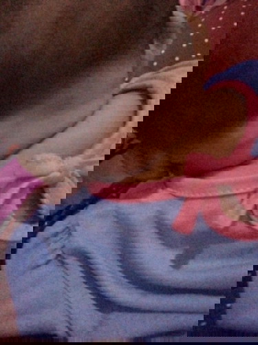 Benjolann d leher belakang kepala bayi