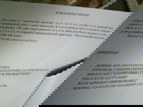 Positive pt pero walang bata nakita🥺🥺