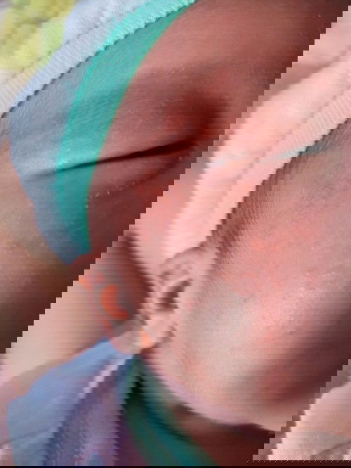 Hi mga momsh anong remedy para sa rashes sa face ni lo 14 days old palang po sya