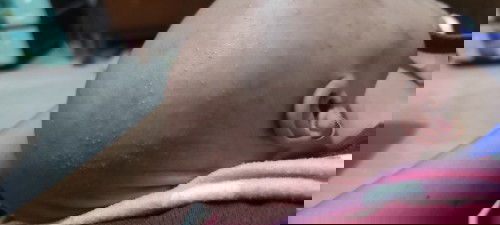 Ini alergi atau apa ya padahal perlengkapan mandi gak ganti sejak awal. Apakah efek dr cukuran ?