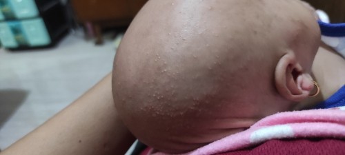 Ini alergi atau apa ya padahal perlengkapan mandi gak ganti sejak awal. Apakah efek dr cukuran ?