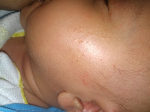 Assalamualaikum,bunda2 di sini ad yg tau ga ini knp ya kulit anak saya byk bintiknya