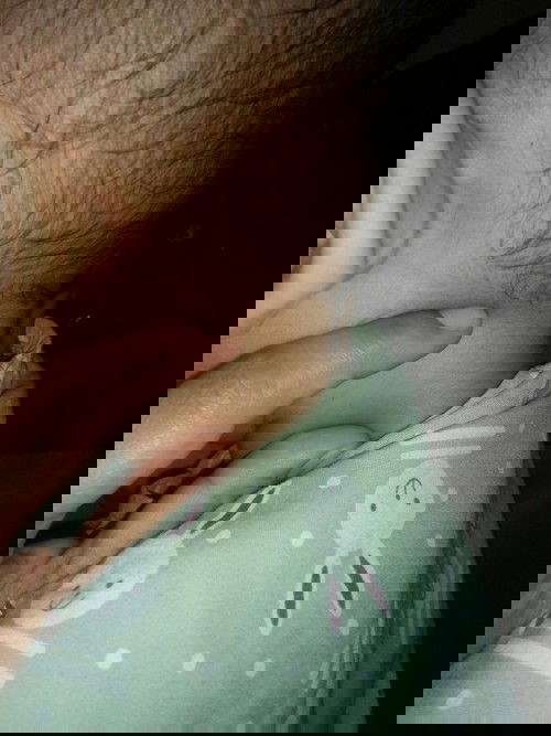 Ada bengkak di belakang telinga.