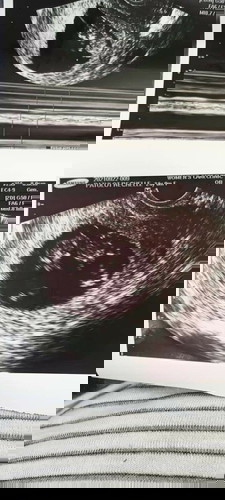 Twins Baby ?TransV ?