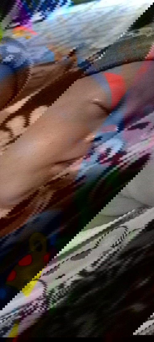 Bintik merah² di wajah dan di leher