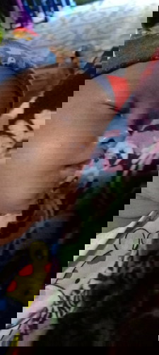 Bintik merah² di wajah dan di leher