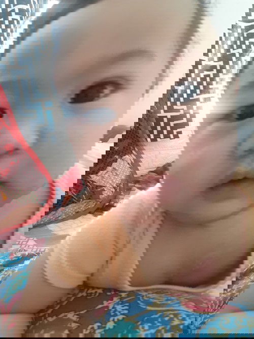 Breath-Holding-Spell