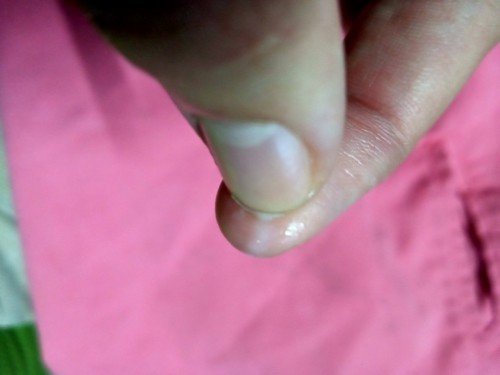 อาการประหลาด