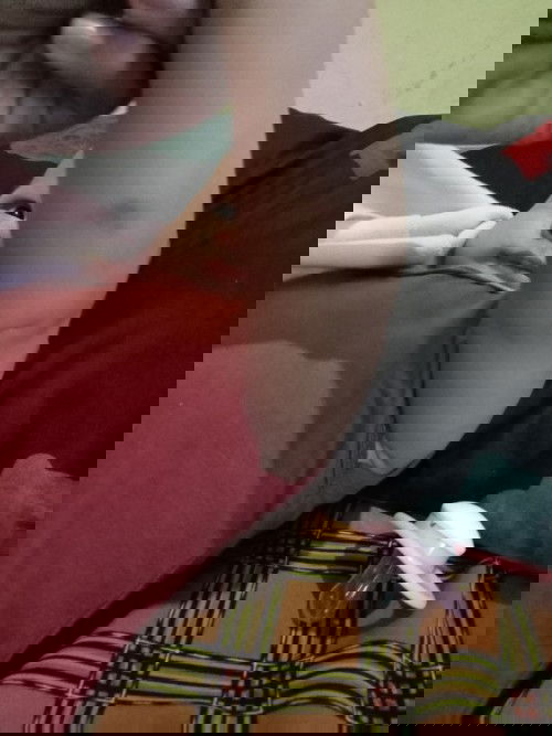 menghilangkan bekas hitam dikulit bayi