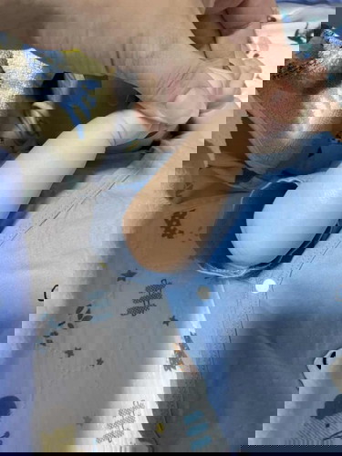 Dry patch on LO limbs