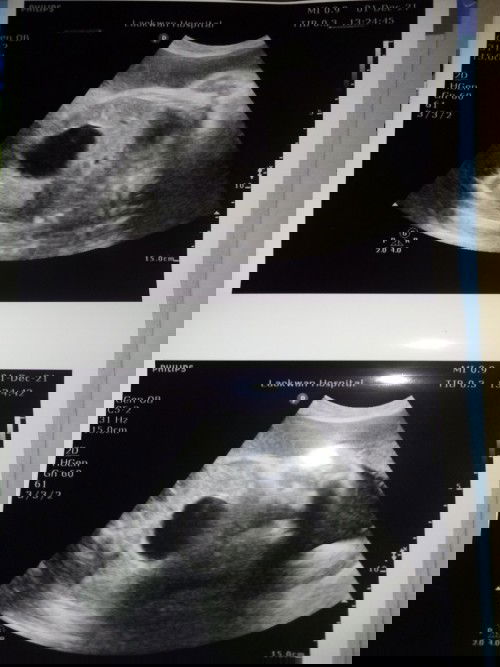 มีๆท่านไหนทราบบ้างคะ