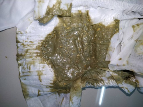 นมผงเพิ่งคลอดได้2เดือนค่ะ