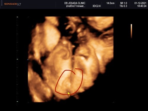 แบบนี้คือผู้หญิงหรือชายคะไม่ค่อยแน่ใจเท่าไหร่