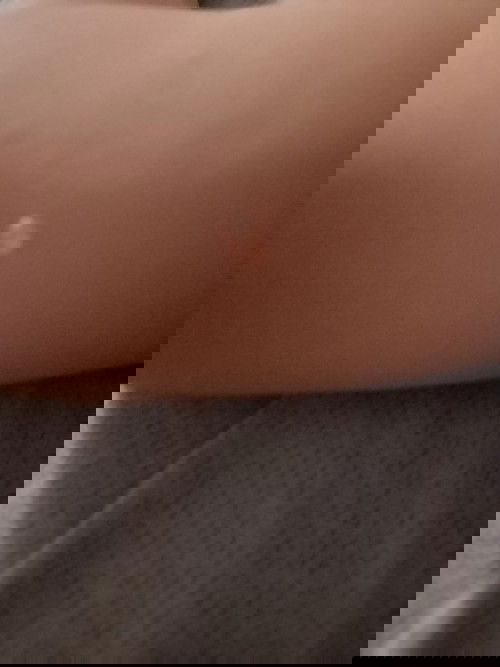 Bayiku umur 16 bulan tiba2 kulitnya bentol dan berair