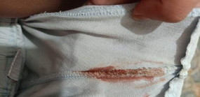 Bakit po kaya may lumalabas na dugo kakahapon , kaninang umaga at ngayon sana masagot 2 months preg.