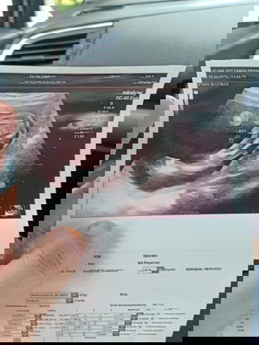 Scan Gender
