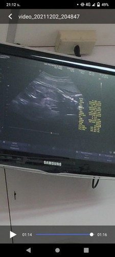 19w6d เด็กน้อยขี้อาย