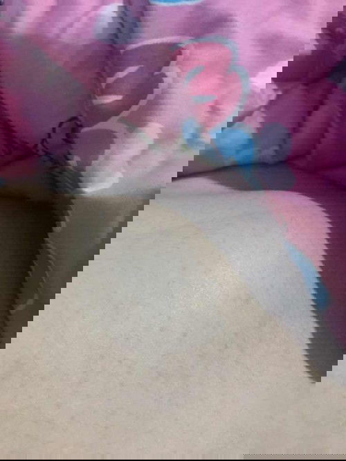 อายุครรภ์14w5d