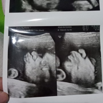 Kelahiran baby
