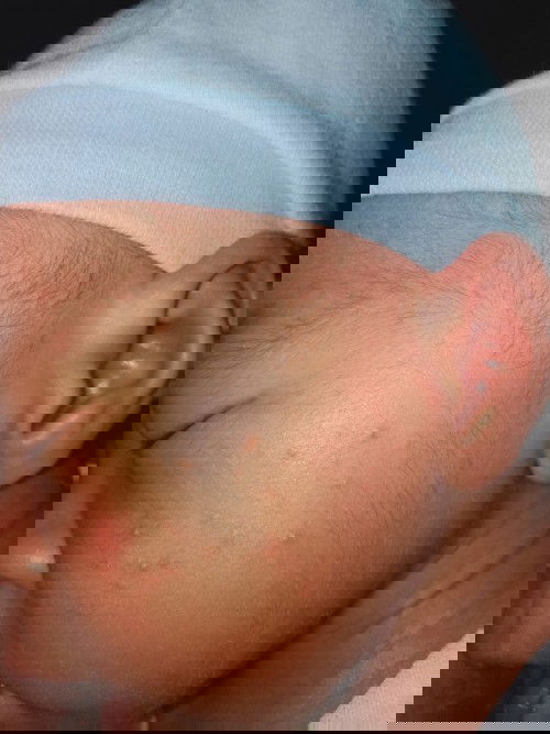 Any advice para po mawala etong nasa mukha ng baby ko.