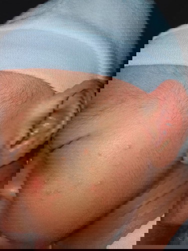 Any advice para po mawala etong nasa mukha ng baby ko.