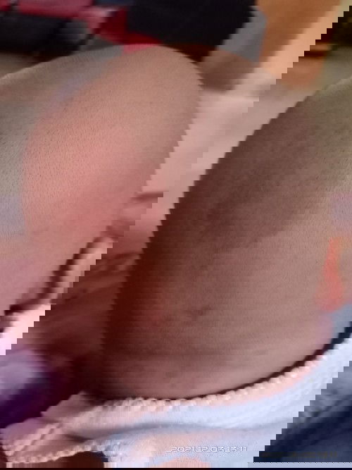 Merah dikulit kepala bayi