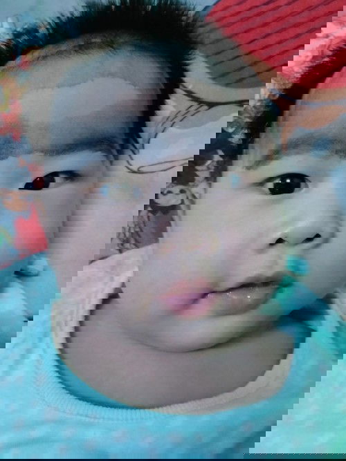 แบบนี้เรียกตาเขหรือเปล่าคะ