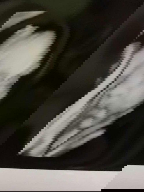 ตรงปากมีรอยยาวถึงจมูกค่ะ