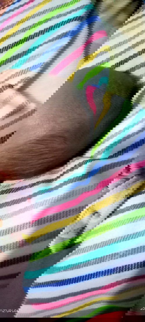 bayi usia 20 hari rambut depan aga rontok