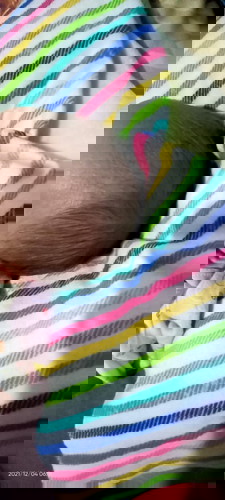 bayi usia 20 hari rambut depan aga rontok