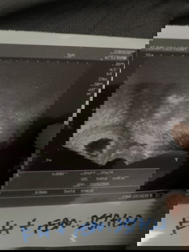 baru 6 weeks pregnant