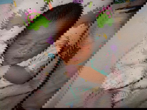 Kemerahan pada kulit