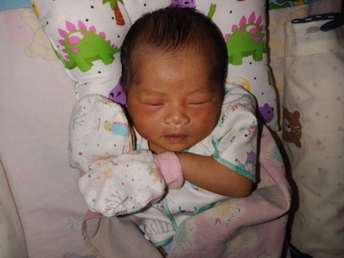 Kemerahan pada kulit