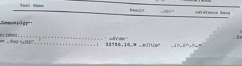 ค่าHCGสูงเกินไปไหมค่ะ