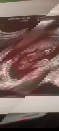 หญิงหรือชายคะ