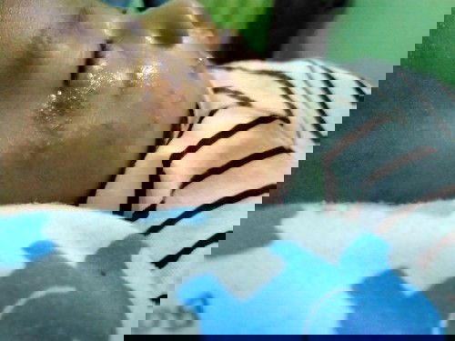 Ada yang tau gak bun, ini kenapa, seluruh tubuhnya kaya merah merah berair,, cacar atau alergi sufor