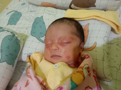 Muka bayi baru lahir merah merah