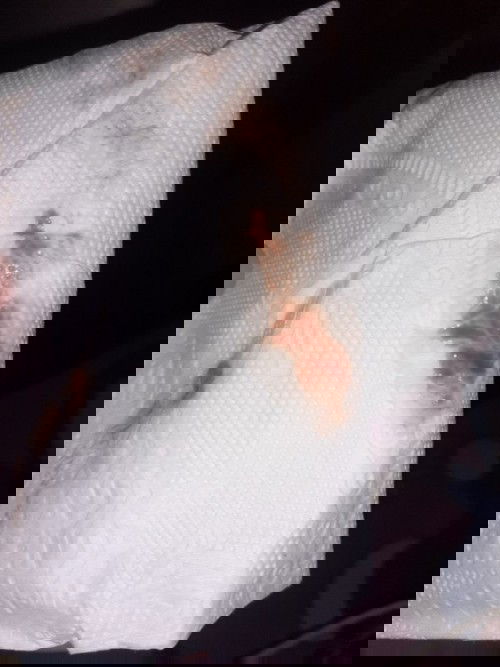 Có phải dấu sinh không m