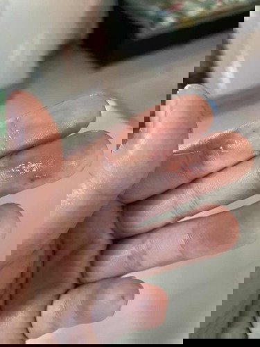 มีมูกเลือดออกแบบนี้ต้องไปรพเลยไหมคะ