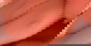 น้อง พึ่งได้1เดือนค่ะมีตุ้มเเข็งๆค่ะ อันตรายไม